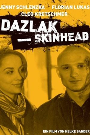 Dazlak – Skinhead